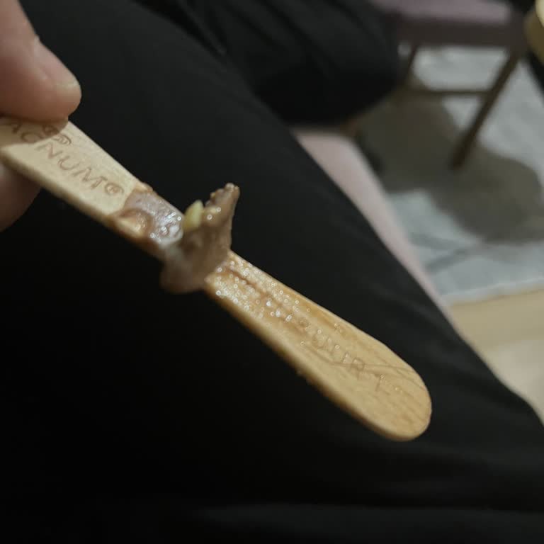 Dondurmadan Kıl Çıkması Ve Müşteri Hizmetlerinden Yanıt Alınamaması