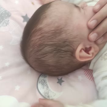 Ecowell Şampuan Sonrası Çocuğumda Cilt Döküntüsü Ve Kızarıklık