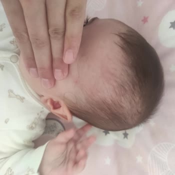 Ecowell Şampuan Sonrası Çocuğumda Cilt Döküntüsü Ve Kızarıklık