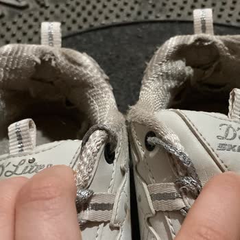 Skechers 8 Ayda Yırtılan Ayakkabı Ve Reddedilen İnceleme Talebi