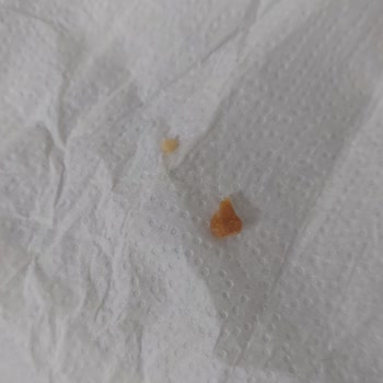 Tarım Kredi Çikolatalı Gofretten Sert Cisim Çıkması Güvenimi Sarsıyor