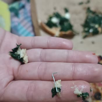 Siparişimde Zımba Çıktı, Sağlığım Tehlikeye Girdi