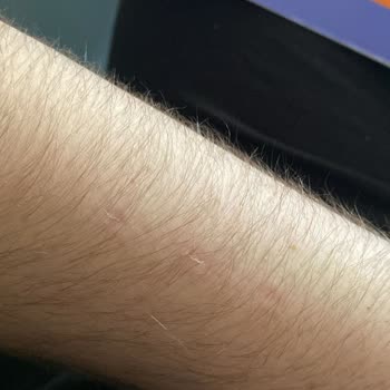 Açılmamış Süpürgeyi İade Edemiyorum Mağdurum