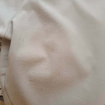 Ferelmoda Pantolonun Hızla Tüylendi, Satıcıdan Kaba Ve Suçlayıcı Yanıt Aldım