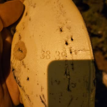 Ayakkabının Tabanından Çıkan Çiviler Ayağımı Yaraladı