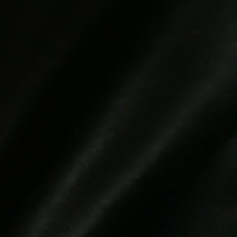 Canlı Destekte Sürekli Bekletilme Ve Yetersiz Bilgilendirme Sorunu