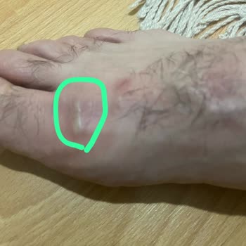 Defolu Ayakkabı Sağlık Sorunu Yarattı, Güvenimiz Sarsıldı