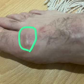 Boyner'den Alınan Mizuno Ayakkabıda Defolu Ürün Ve Sağlık Sorunu