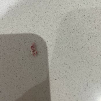 UNO Tost Ekmeğinde Plastik Parça Ve Yetersiz Çözüm