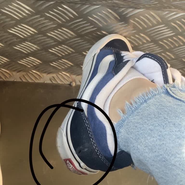 Satın Aldığım Ayakkabının Yırtılması Ve İade Sürecinde Yaşanan Sorun