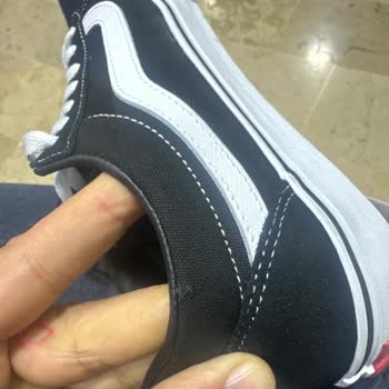 Aldığım Ayakkabıda Hızlı Yıpranma Ve İade Sorunu