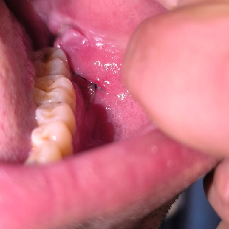 Dikiş Alımı Sonrası Eksik Ve Yetersiz Kontrol