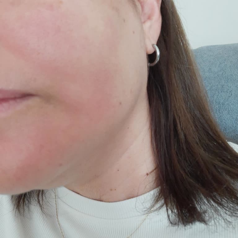 Я испытала жжение от солнцезащитного крема Loreal Paris Bright Reveal