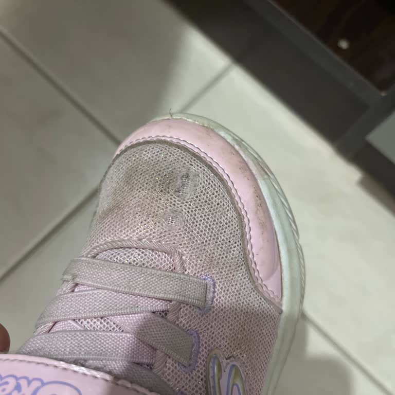 4 Yaşındaki Çocuğumun Skechers Ayakkabısı 4 Ayda Yırtıldı, Garanti Kabul Edilmedi