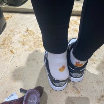 Aldığım Ayakkabı İlk Giyişte Ayağımı Yaraladı Para İadesi İstiyorum