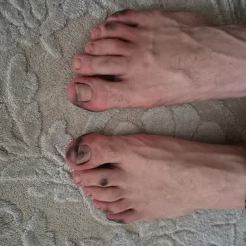 Ayakkabılar Boya Akıtıyor, Değişim Ve İade Reddedildi!