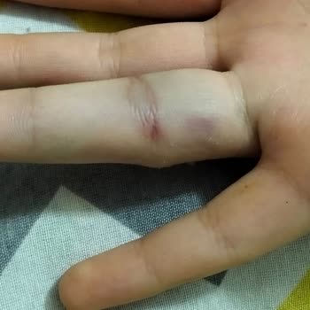 Öğretmenin Sorumsuz Ve Sert Tavrı Kızımın Kazası Sonrası Bizi Mağdur Etti