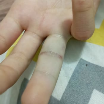 Kızımın Yaralanmasında Öğretmenin Sorumluluk Ve Üslup Eksikliği