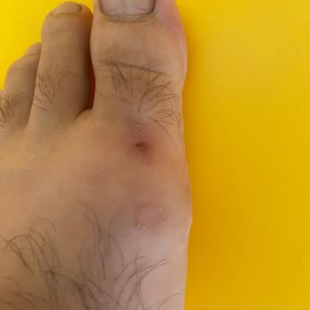 Aldığım Kundura Ayağımı Yaraladı, Değişim Yapılmadı