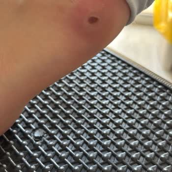 Guess Ayakkabı Sağlığımı Bozdu, Operasyon Geçirmek Zorunda Kaldım