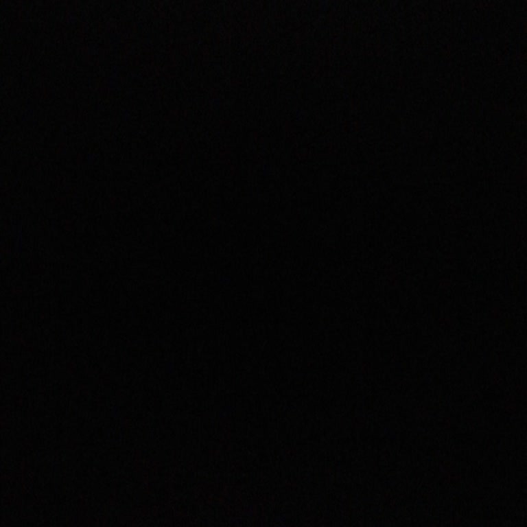 Kahramanmaraş Adsh Diş Tedavisinde Yetersiz İlgi Ve Başarısız Hizmet