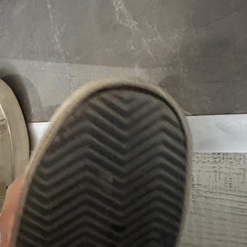 Golden Goose Ayakkabıda Kısa Sürede Oluşan Sorun Ve Çözüm Talebi