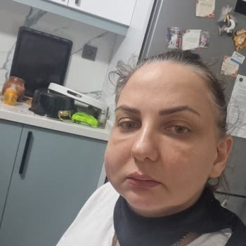 Endolift Sonrası Yüzümde Geçmeyen Ödem Ve İlgisiz Yaklaşım