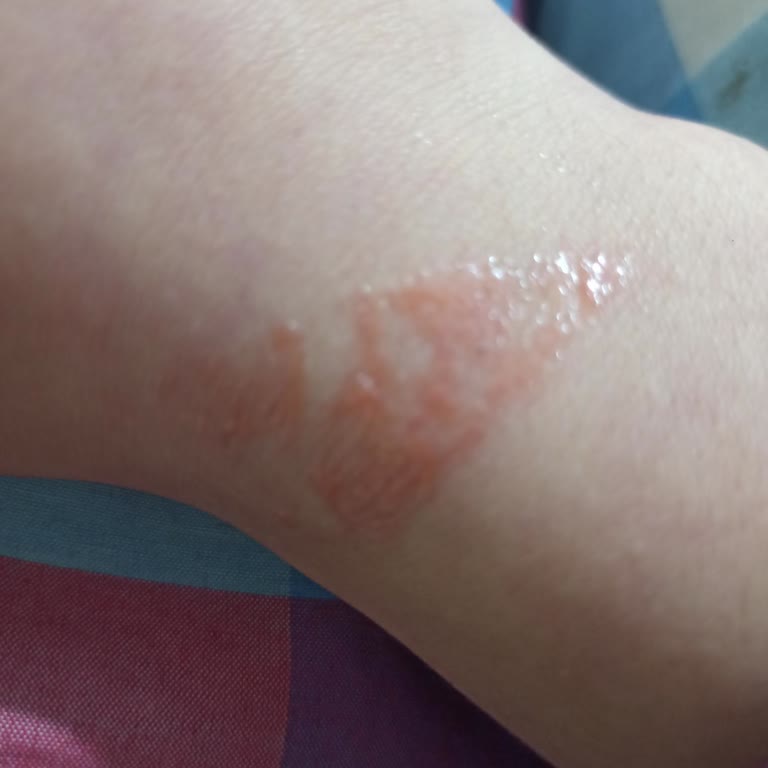 Vivet Ağda Hiçbir Şekilde Kullanılamıyor, Tüyleri Almıyor Ve Ciltte Kalıyor