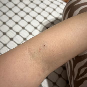 Çekmeköy Devlet Hastanesi Acil Serviste Yetersiz İlgi Ve Yanlış Bilgilendirme Nedeniyle Mağduriyet