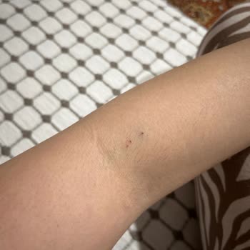 Çekmeköy Devlet Hastanesi Acil Serviste Yetersiz İlgi Ve Yanlış Bilgilendirme Nedeniyle Mağduriyet