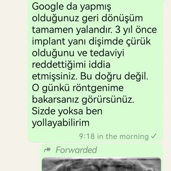 Yüksek Ücretli İmplantlar Kısa Sürede Düştü, Açıklamalar Tatmin Edici Değil
