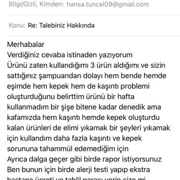 Şampuan Kullanımı Sonrası Kaşıntı Ve Kepek Sorunu Yaşadık