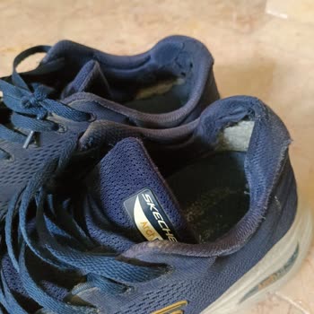 Skechers Ayakkabım Kısa Sürede Yıprandı İncelemede Kullanıcı Hatası Dendi