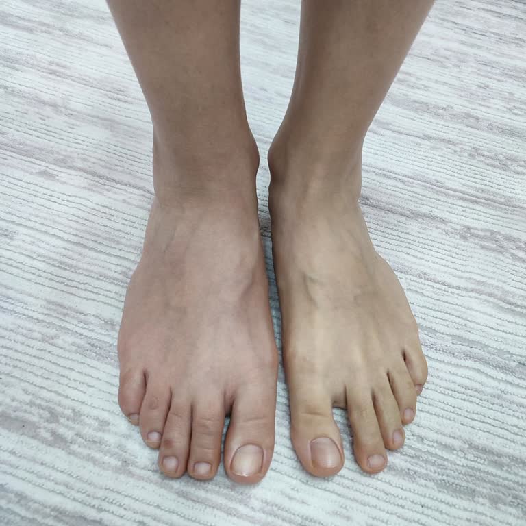 Ameliyat Sonrası Yapılan Yanlış İğne Sonucu Kalıcı Sinir Hasarı Ve İlgisiz Hemşireler