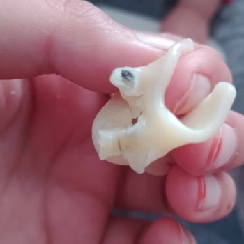 Makarnada Böcek Şoku Ve Sağlık Endişesi