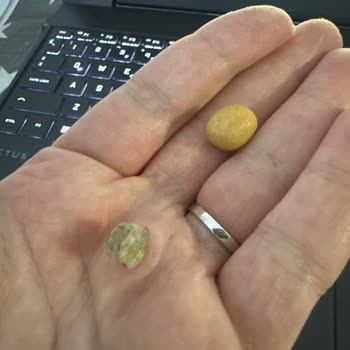 Kuruyemiş İçinden Taş Çıktı, Dişim Kırıldı