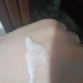 Bioderma Mat Control Ürününün Akışkanlığı Ve Yüzde Yanma Sorunu