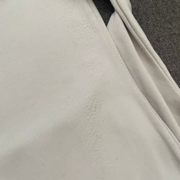 Cevapsız Müşteri Hizmetleri Ve Kalitesiz Ürün Mağduriyeti