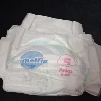 Molfix Bebek Bezinde Sakıza Benzer Yapışkan Sorunu
