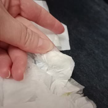 Molfix Bebek Bezinde Sakıza Benzer Yapışkan Sorunu