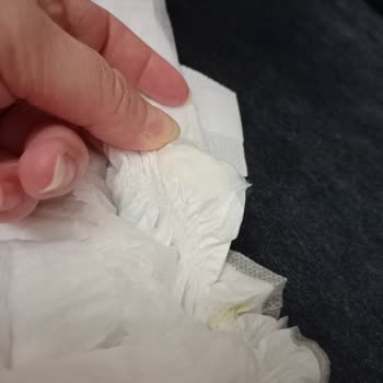 Molfix Bebek Bezinde Sakıza Benzer Yapışkan Sorunu