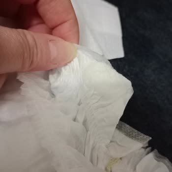 Molfix Bebek Bezinde Sakıza Benzer Yapışkan Sorunu