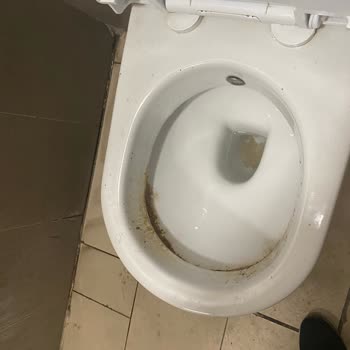 İzmir Torbalı Devlet Hastanesi Tuvaletlerinde Temizlik Sorunu