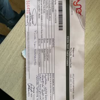 Asics Nimbus 26 Koşu Ayakkabısında Ön Uç Batma Sorunu