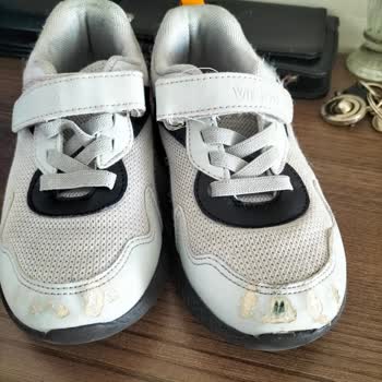 Aldığım Ayakkabıların Derisi Kısa Sürede Soyuldu, Destek Alamadım