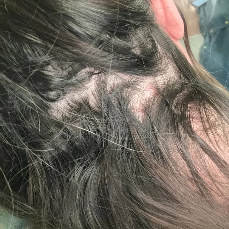 Mikro Kaynak Uygulamasında Yaşanan Sorunlar Ve Mağduriyet