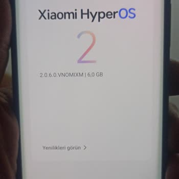 Aldığım Telefonun Kamerası Çalışmıyor, Satıcı Ve N11 Sorunu Çözmüyor