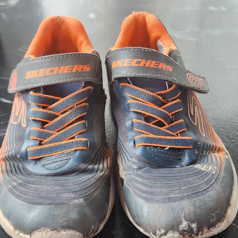 Satın Aldığım Skechers Ayakkabıda Kısa Sürede Deformasyon Ve İlgisiz Mağaza