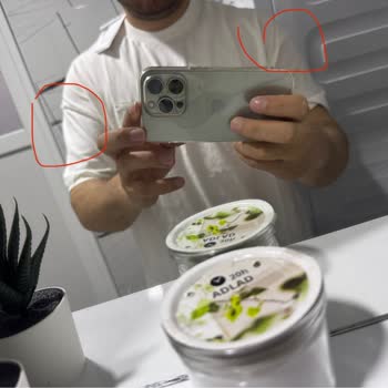 Defolu Ürün Satışı Ve İade Sürecinde Mağduriyet