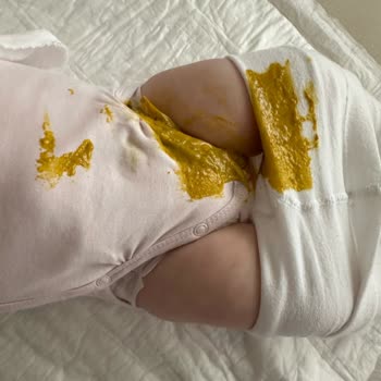 Sleepy Natural 3 Numara Bezde Sürekli Sızıntı Sorunu